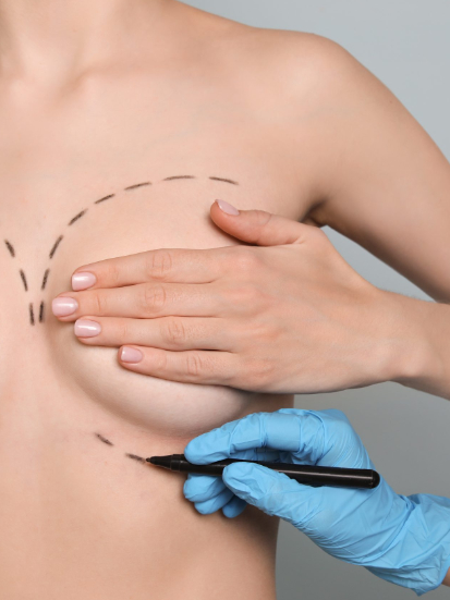 Breast Surgery
